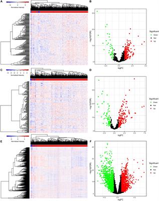 The Construction and Analysis of Tumor-Infiltrating Immune Cells and ceRNA Networks in Bladder Cancer